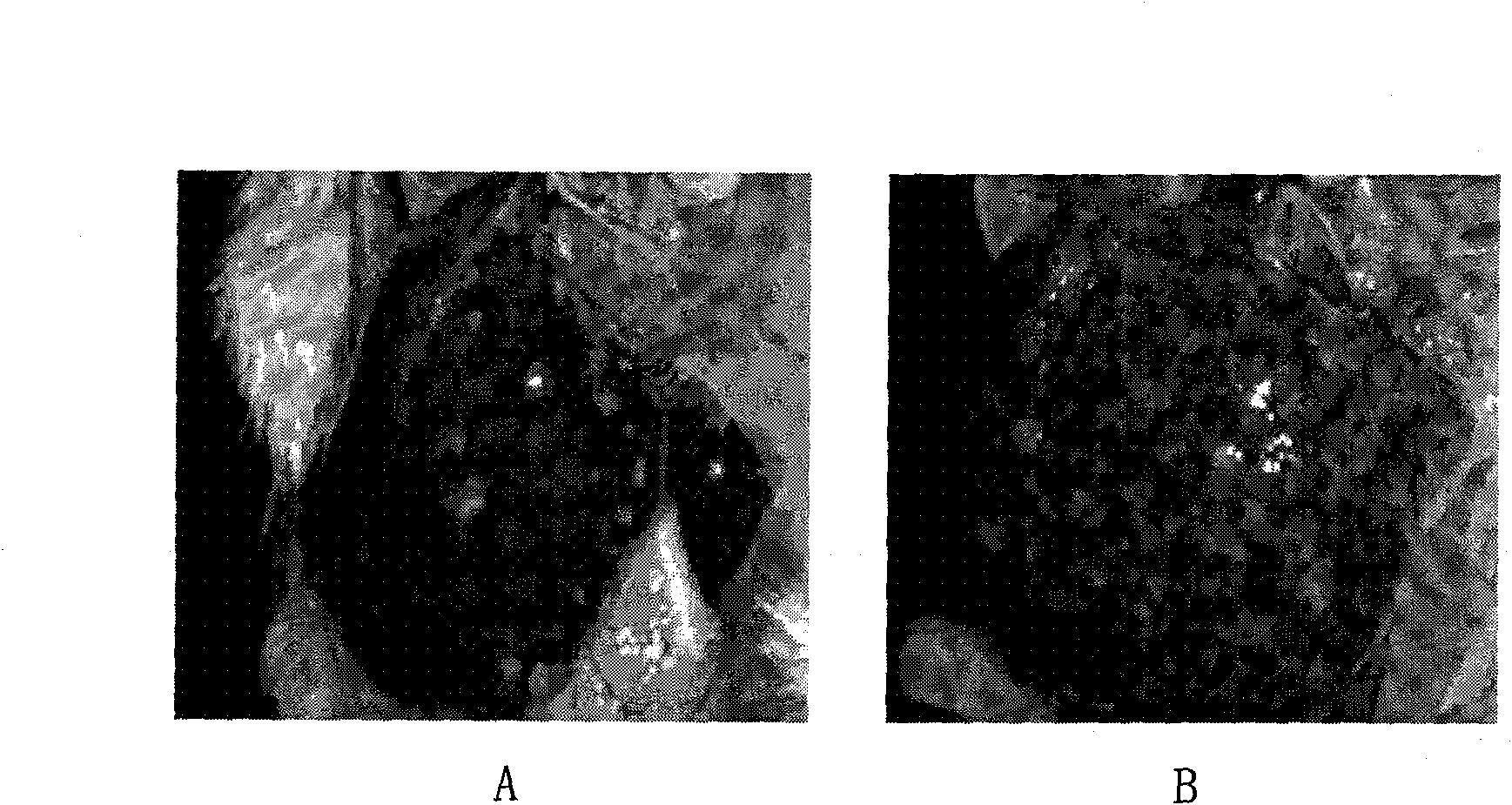 Praziquantel injection, preparation method and application thereof