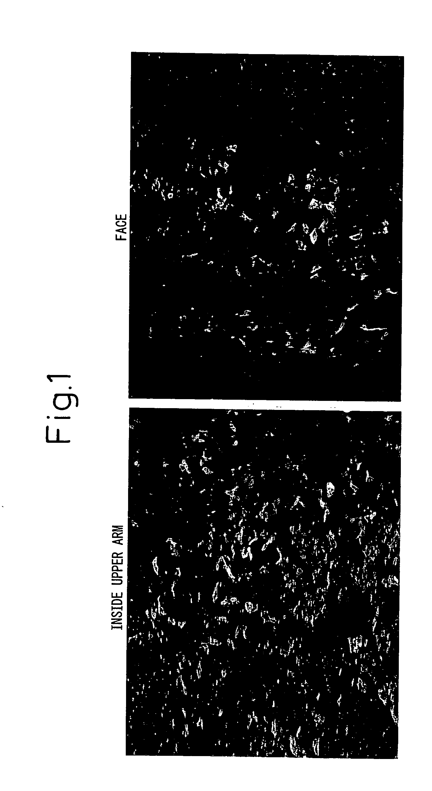 Method for evaluating oxidized protein in horny cell layer