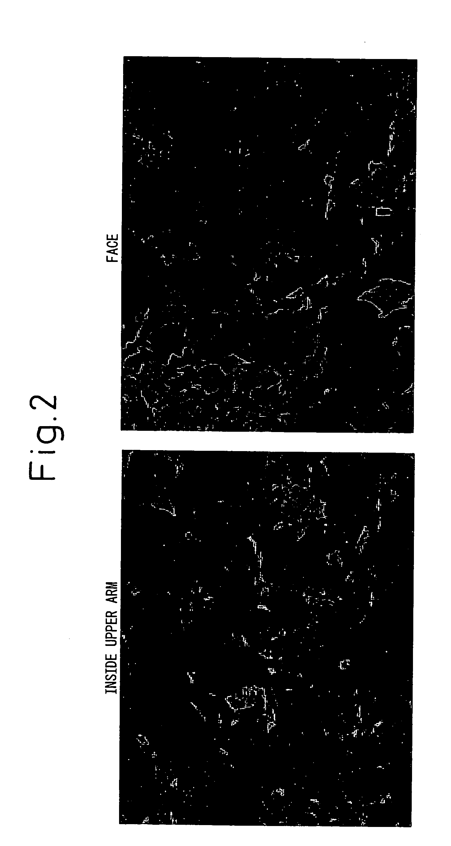 Method for evaluating oxidized protein in horny cell layer