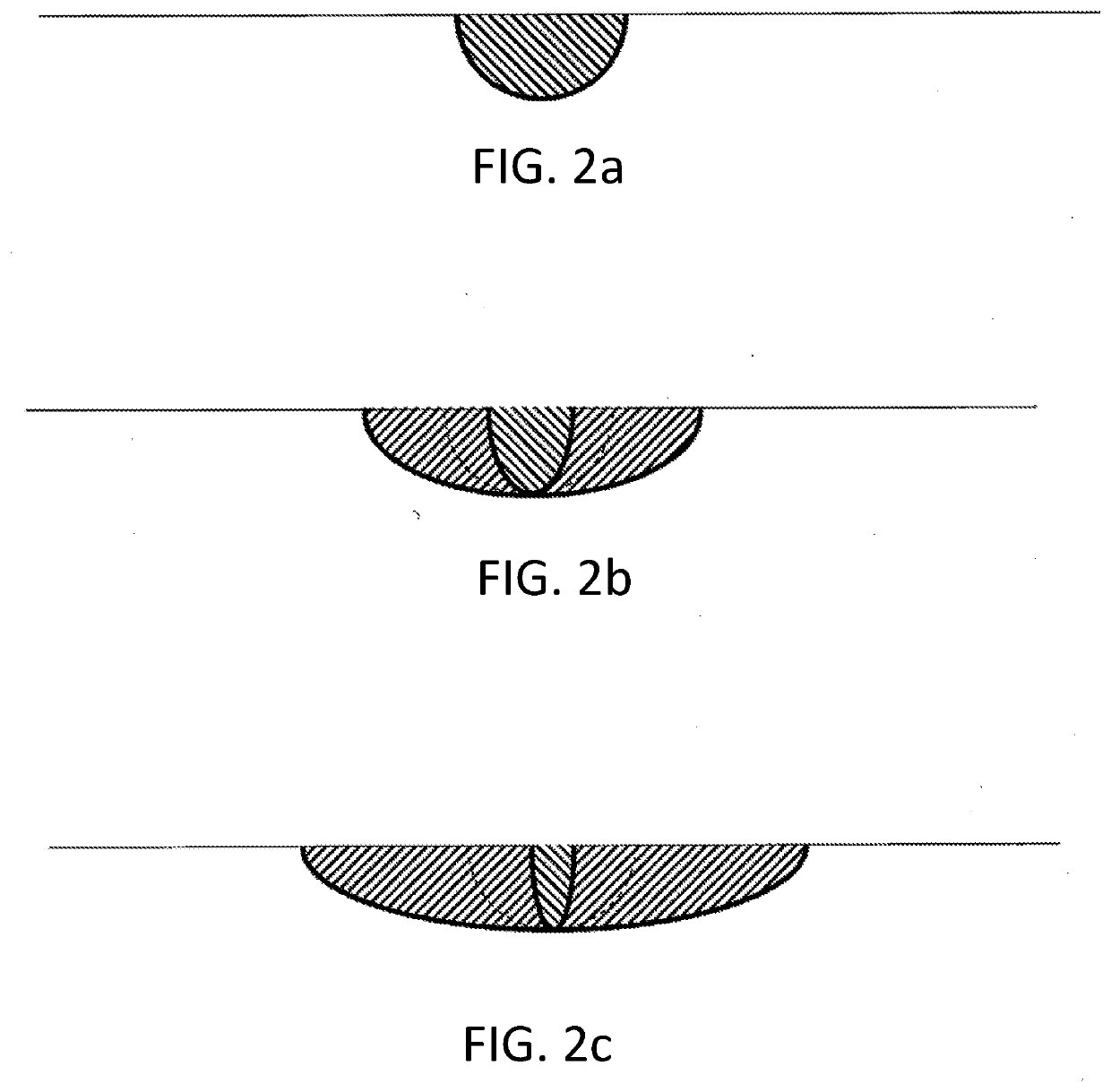 Soft Tissue Selective Ablation Surgical Systems