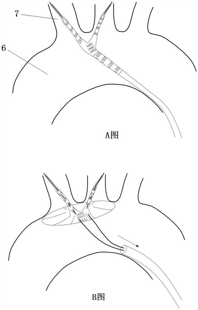 Covered stent for reconstructing aortic arch and branches thereof