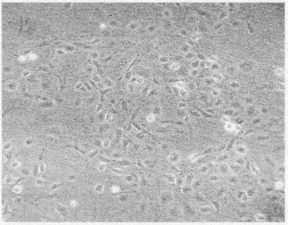 Preparation method of stem cell preparation for repairing diabetes pancreas islet function