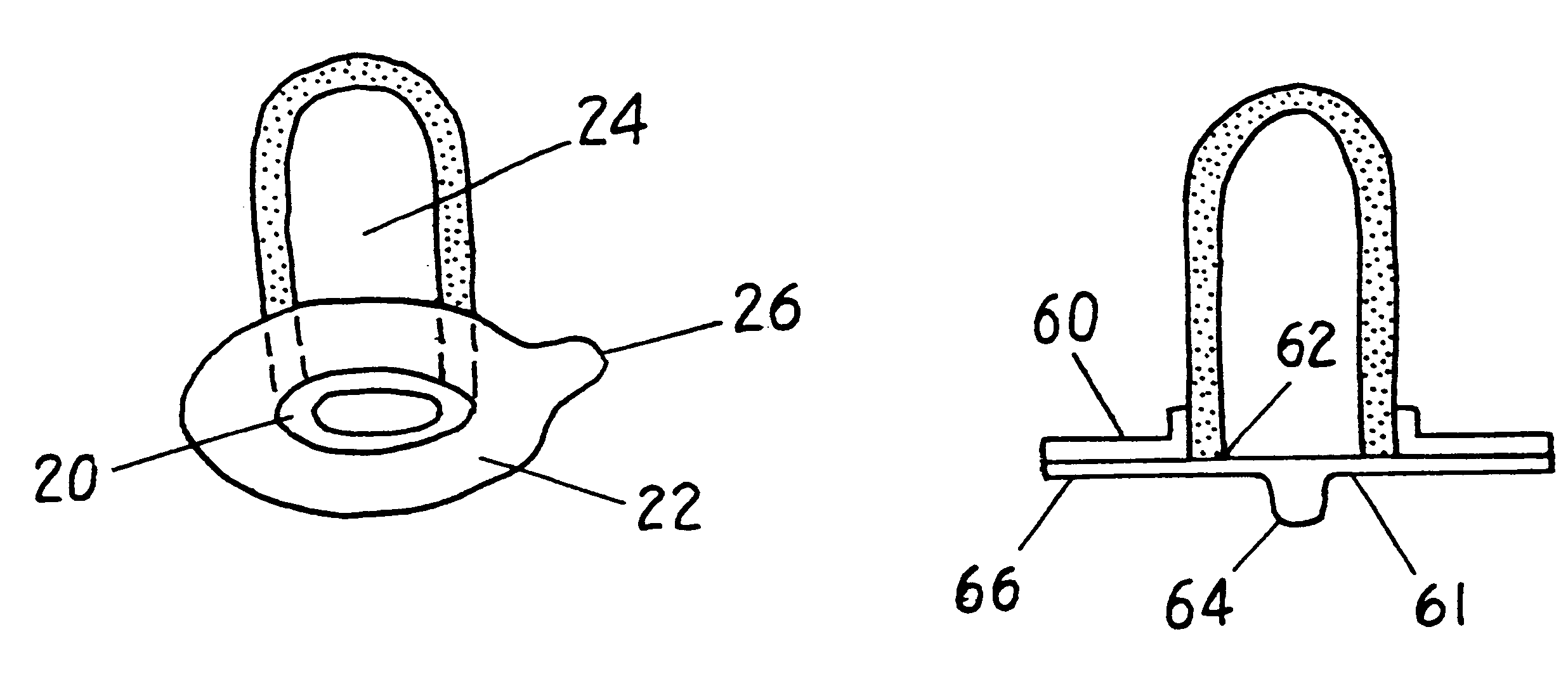 Thermal compress for appendage and method of treating appendage with thermal compress