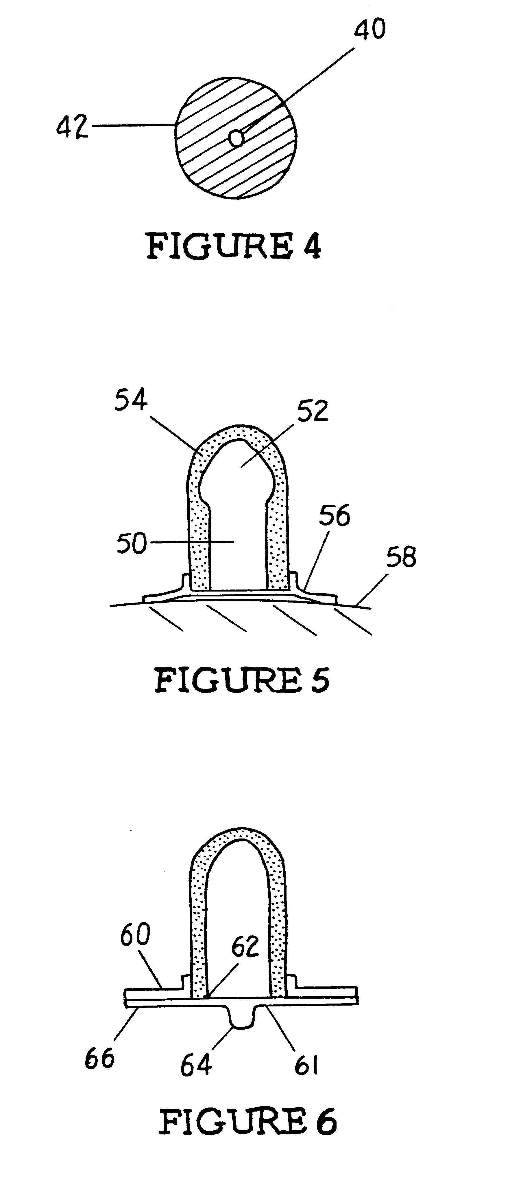 Thermal compress for appendage and method of treating appendage with thermal compress