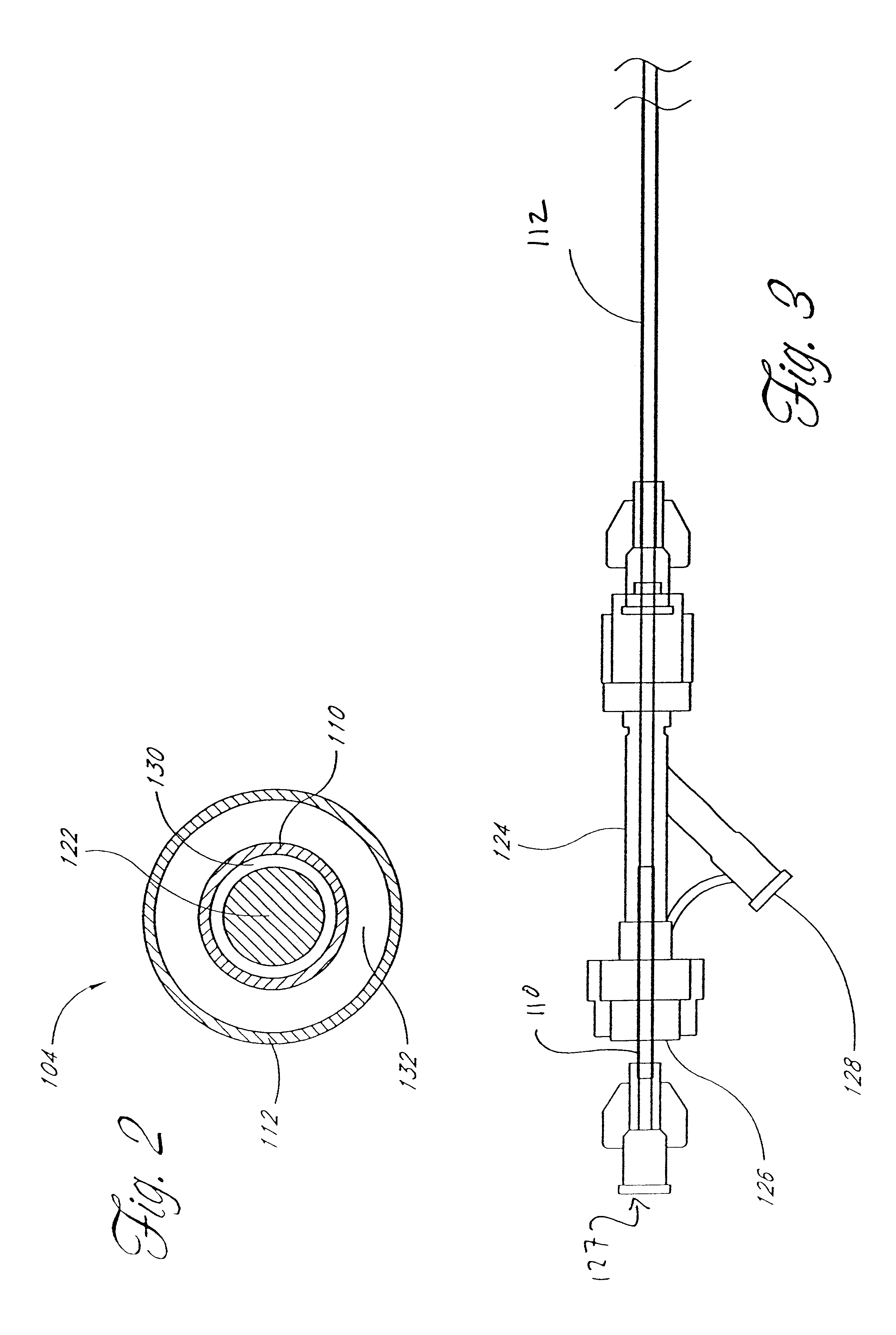 Formable orthopedic fixation system