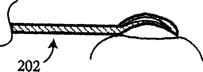 Epithelial pocket expanding tool and combination epithelial delaminating device and corneal reformer