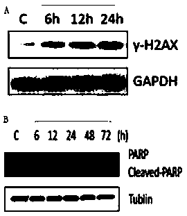 Apoferritin-benzothiazole compound complex as well as preparation method and application thereof