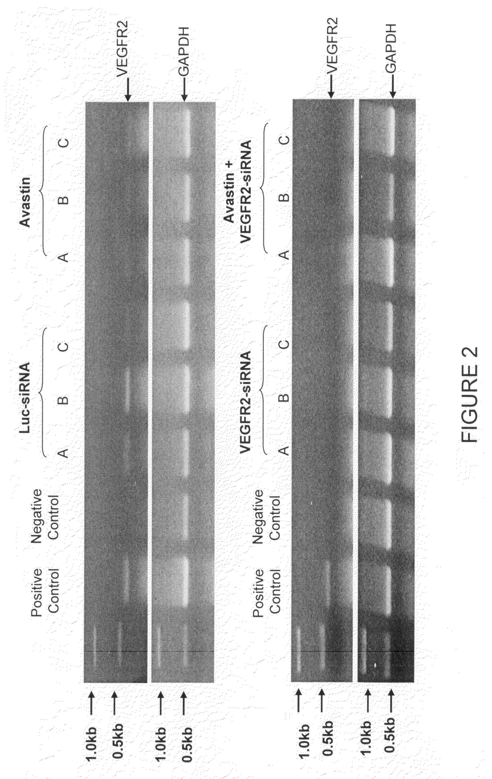 Composition and methods of RNAi therapeutics for treatment of cancer and other neovascularization diseases