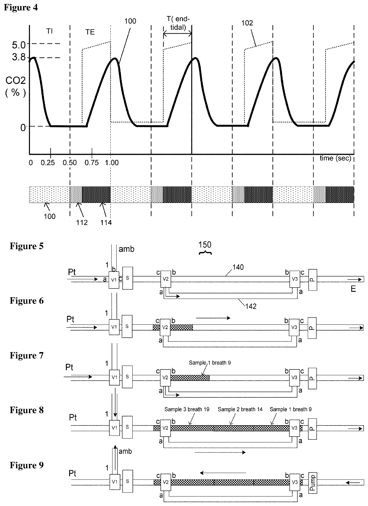 Neonatal carbon dioxide measurement system