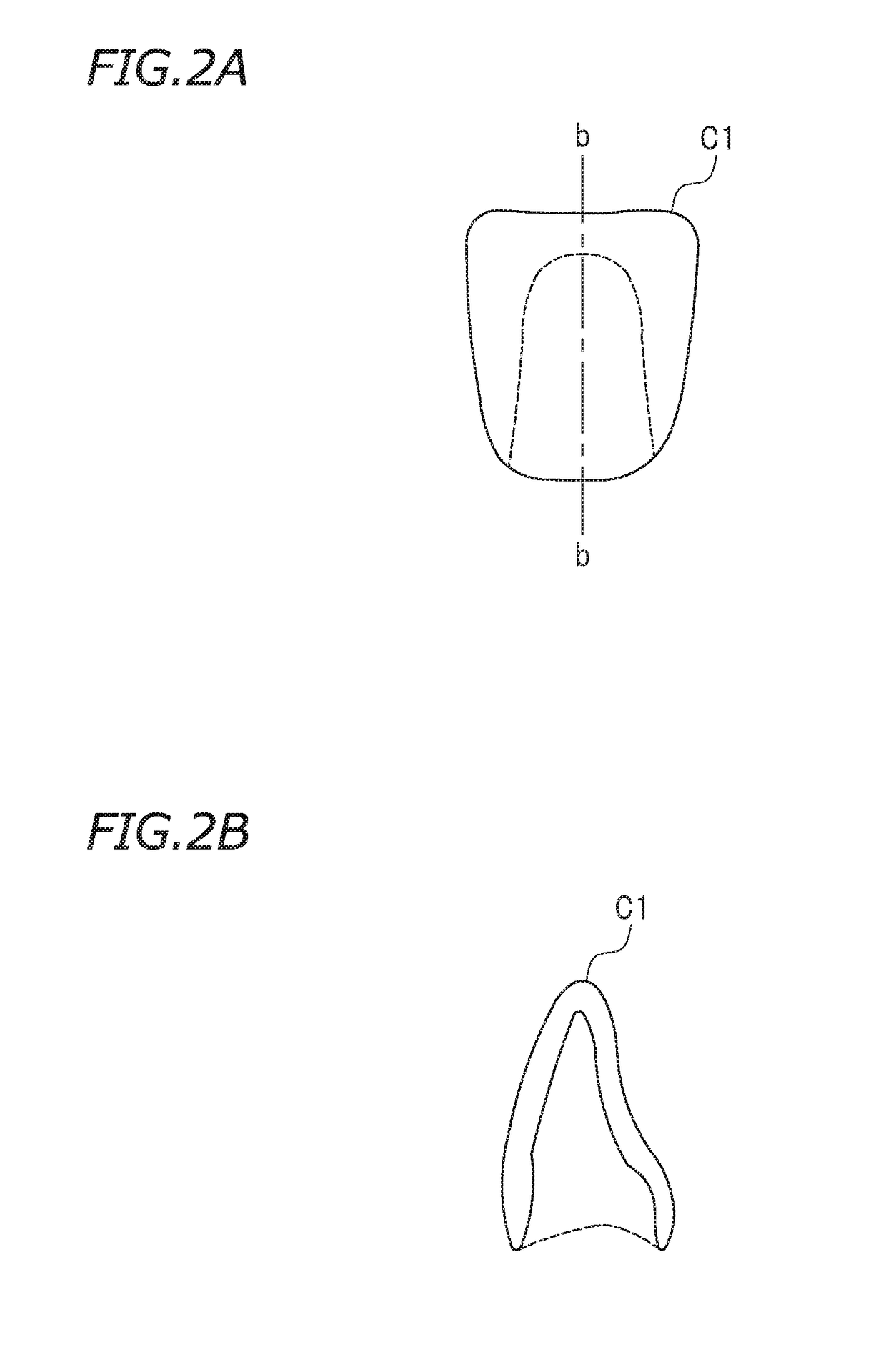 Crown prosthesis preparing system, crown prosthesis preparing method, and non-transitory storage medium storing program for preparing crown prosthesis