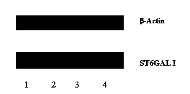 SiRNA (small interfering Ribose Nucleic Acid) capable of preventing and controlling influenza, and pharmaceutical composition and medical application thereof