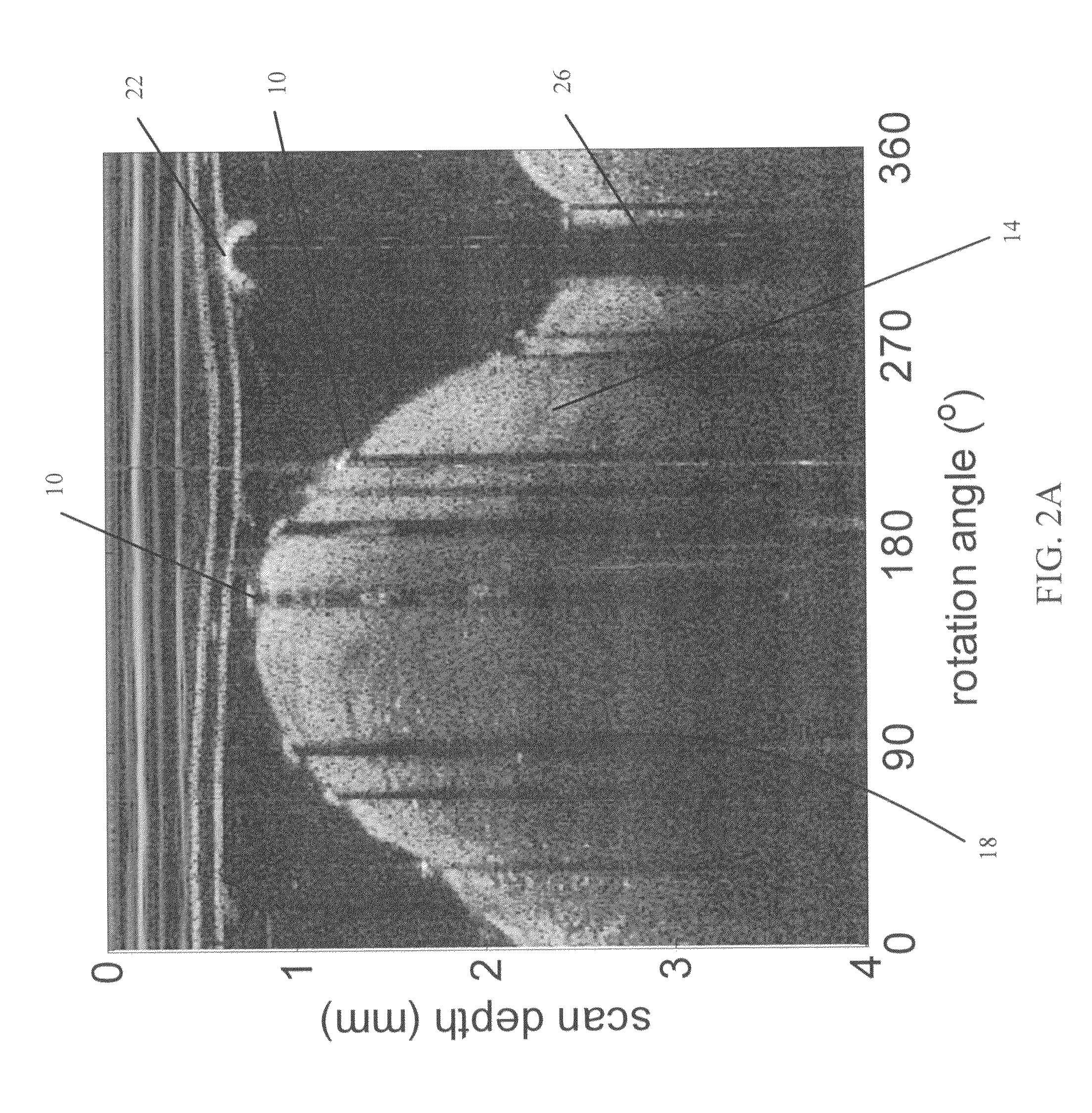 Methods for stent strut detection and related measurement and display using optical coherence tomography
