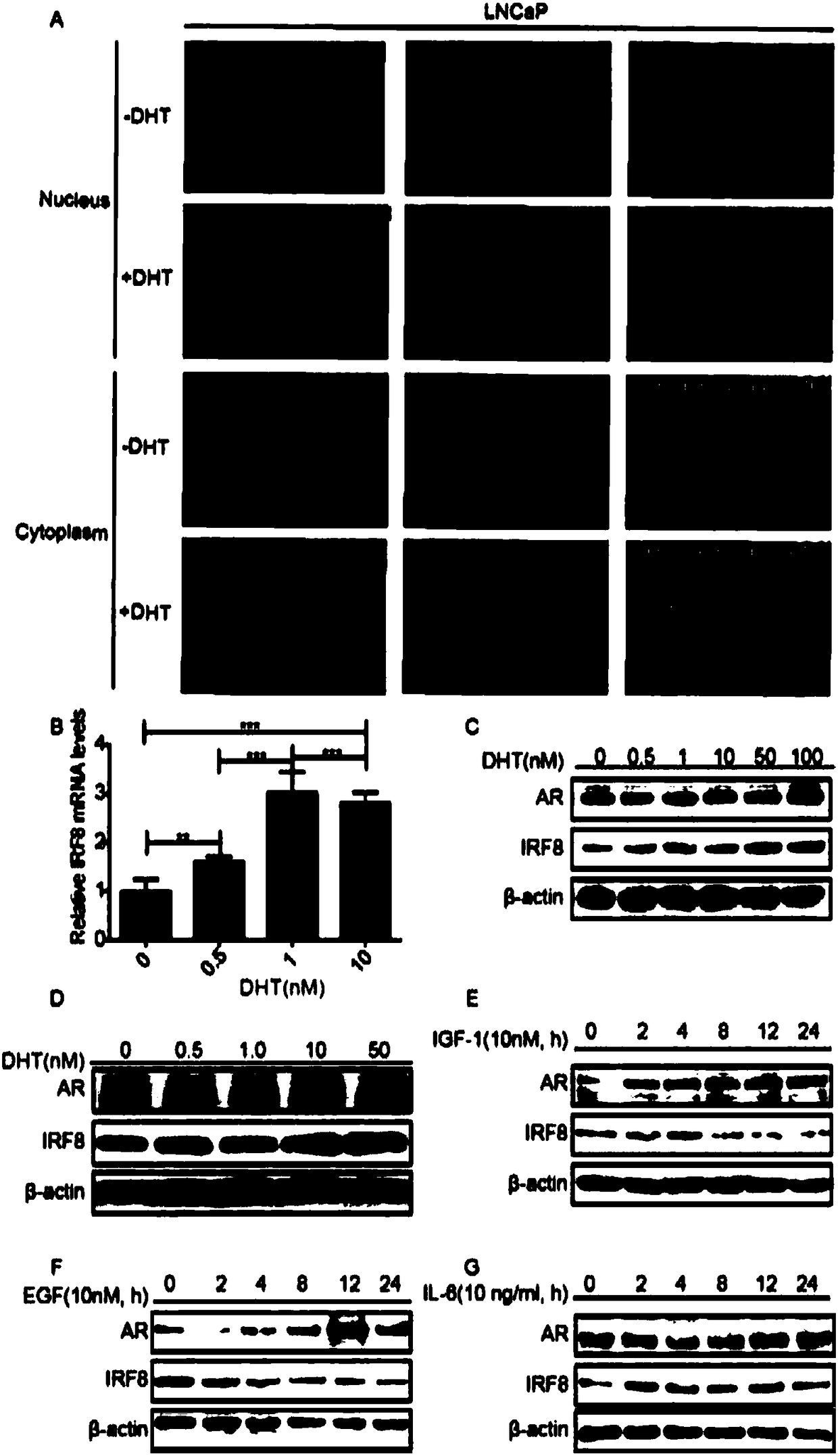 Application of substance for inducing IRF8 expression in preparation of medicine for treating disease due to abnormal expression of androgen acceptor