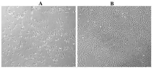 Method for Directed Induction and Differentiation of Human Embryonic Stem Cells into Corneal Endothelial Cells