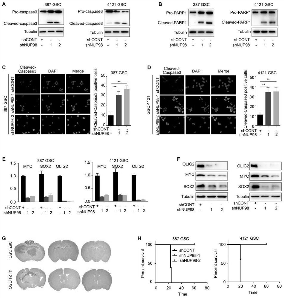 Application of NUP98 gene as glioma stem cell specific molecular marker and glioblastoma treatment and prognosis target