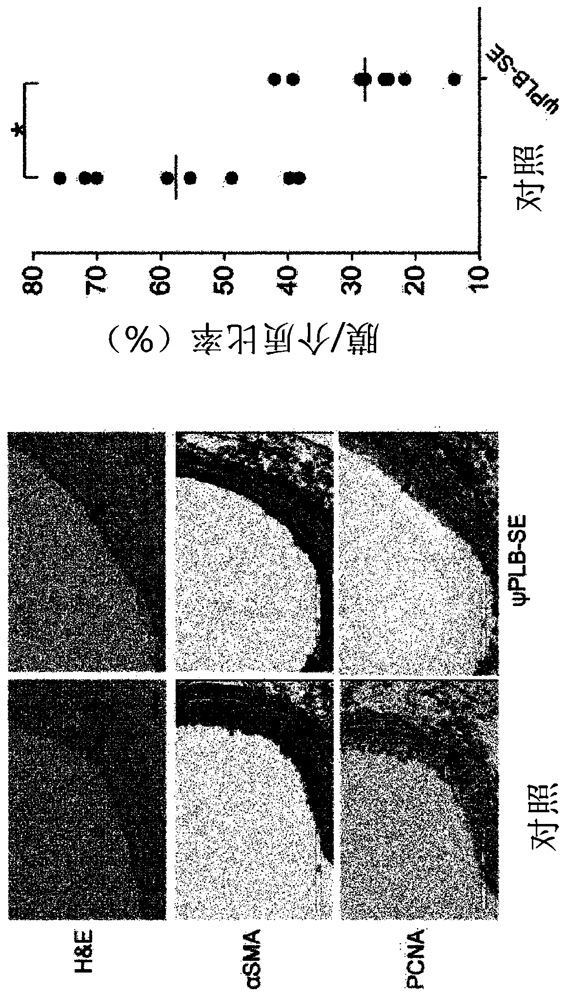 Composition comprising protein phosphatase 1 inhibitory peptide for treating vascular diseases