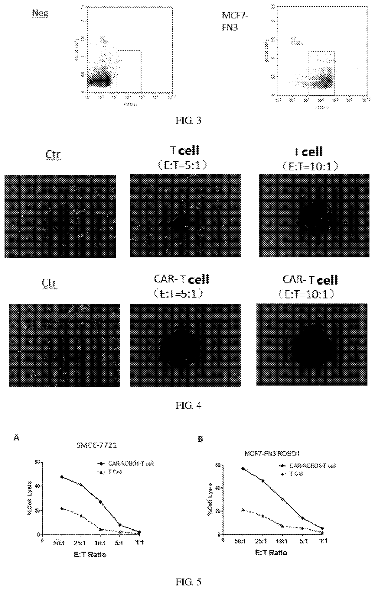 Anti-ROBO1 CAR-T cell, and preparation and application thereof