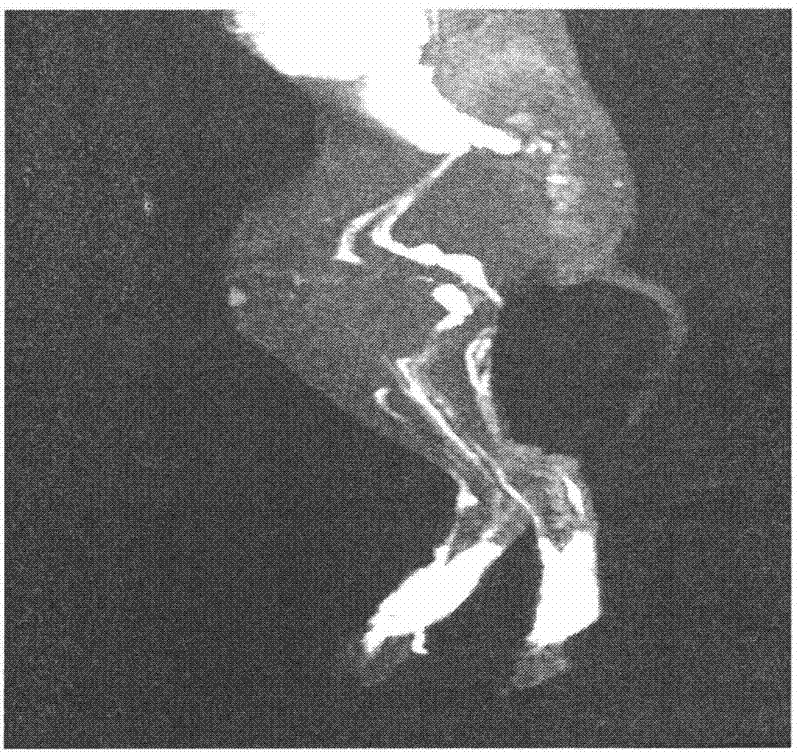 Polysaccharide macromolecular paramagnetic metal complex and synthesis method and application thereof