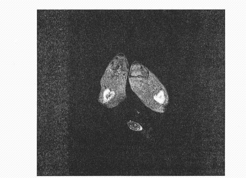 Polysaccharide macromolecular paramagnetic metal complex and synthesis method and application thereof