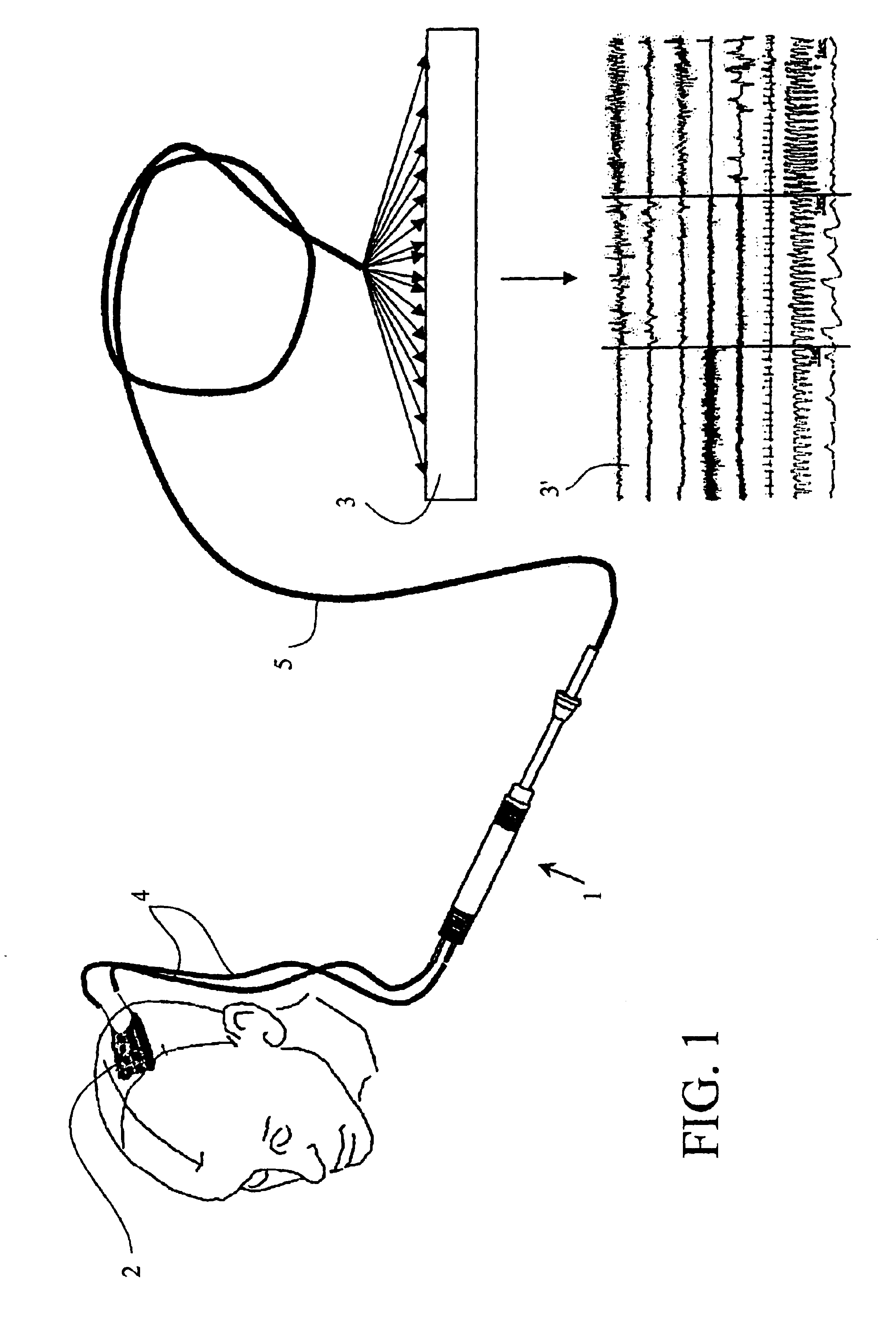 Multi-contact connector for electrode for example for medical use