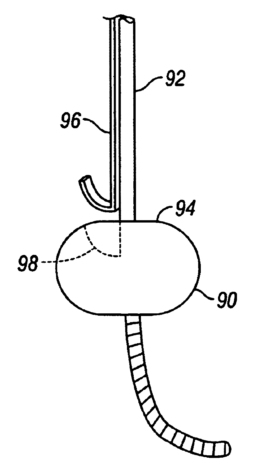 Methods and apparatus for forming anastomotic sites
