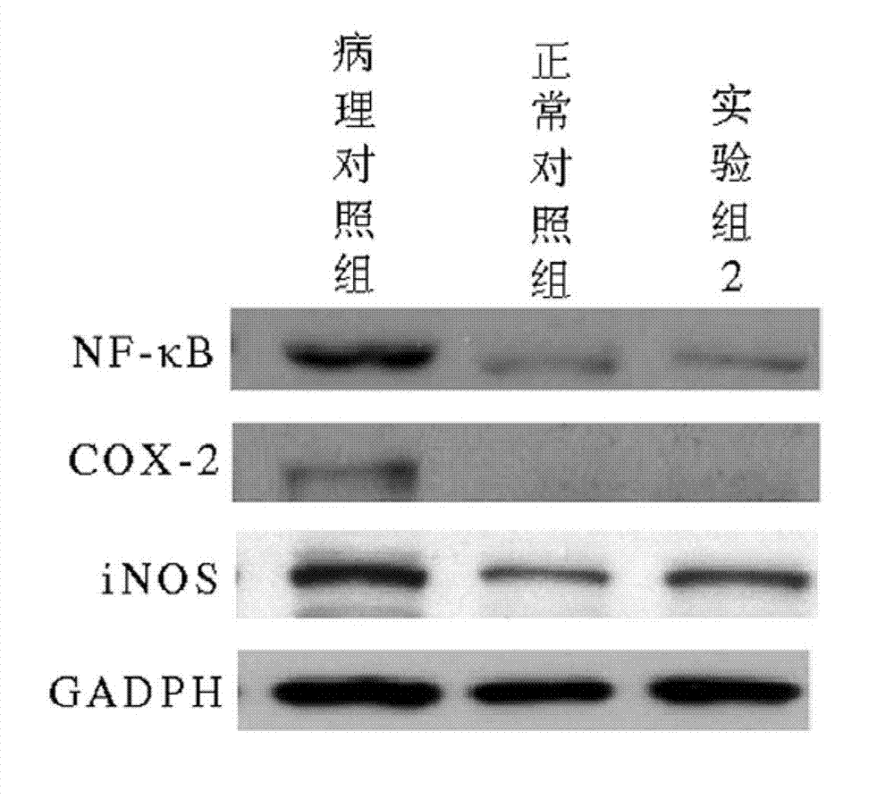 Method for treating and/or preventing inflammation and cutaneous photodamage by using water soluble extract from plant of Solanum genus and having photoprotective effect