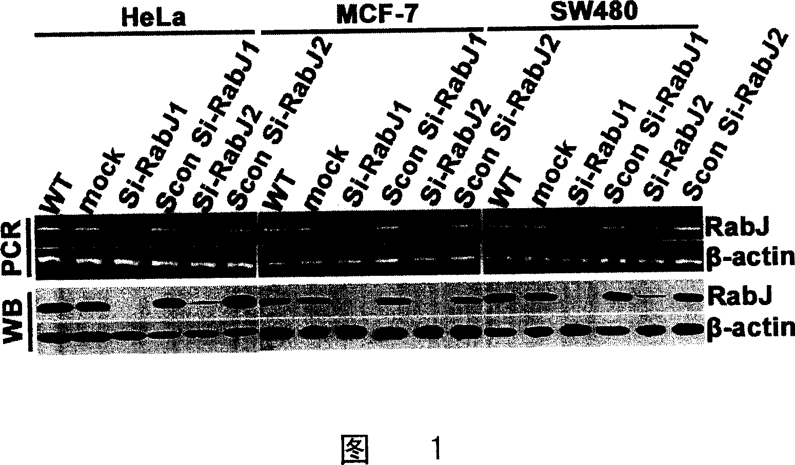 SiRNA for inhibiting human Rabj gene expression and its application