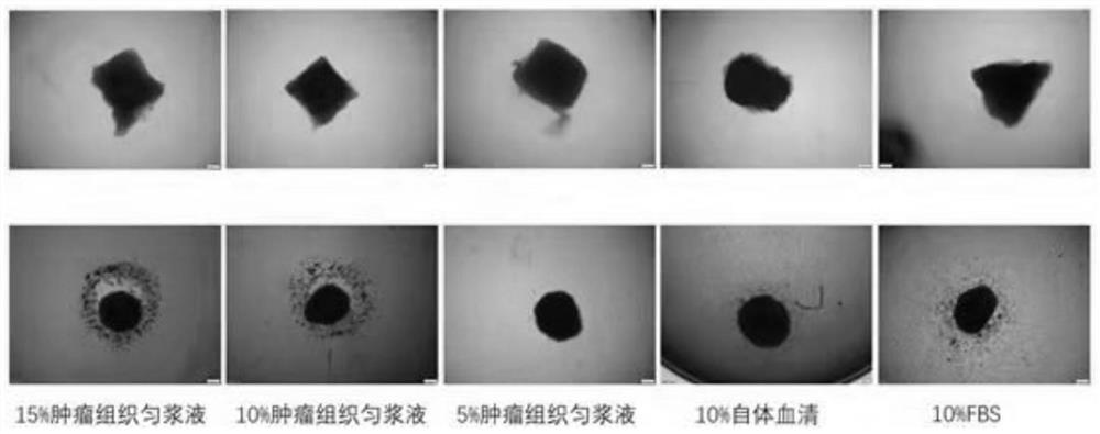 Individualized drug sensitivity detection method for tumor tissue homogenate substituted serum micro-tissue block