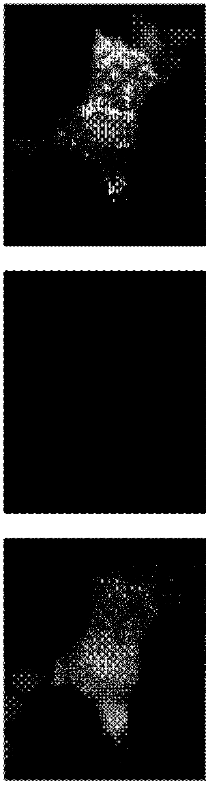 Monoclonal antibody against claudin-18 for the treatment of cancer