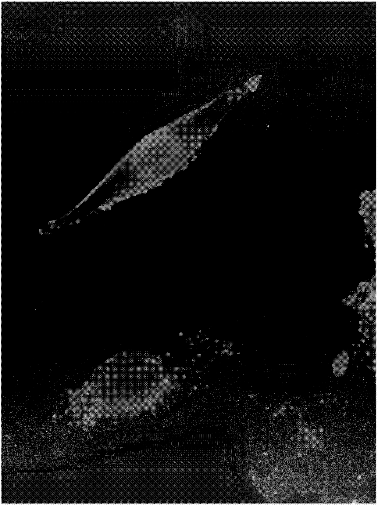 Monoclonal antibody against claudin-18 for the treatment of cancer