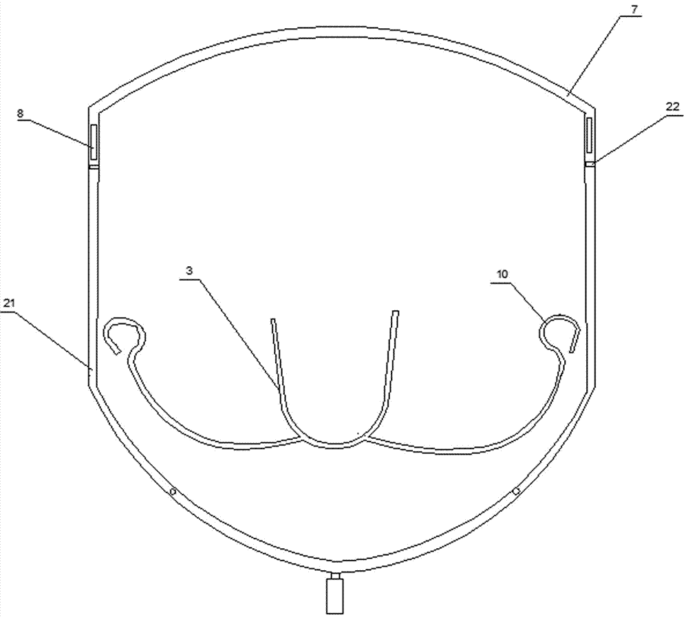 Orthodontic method and device