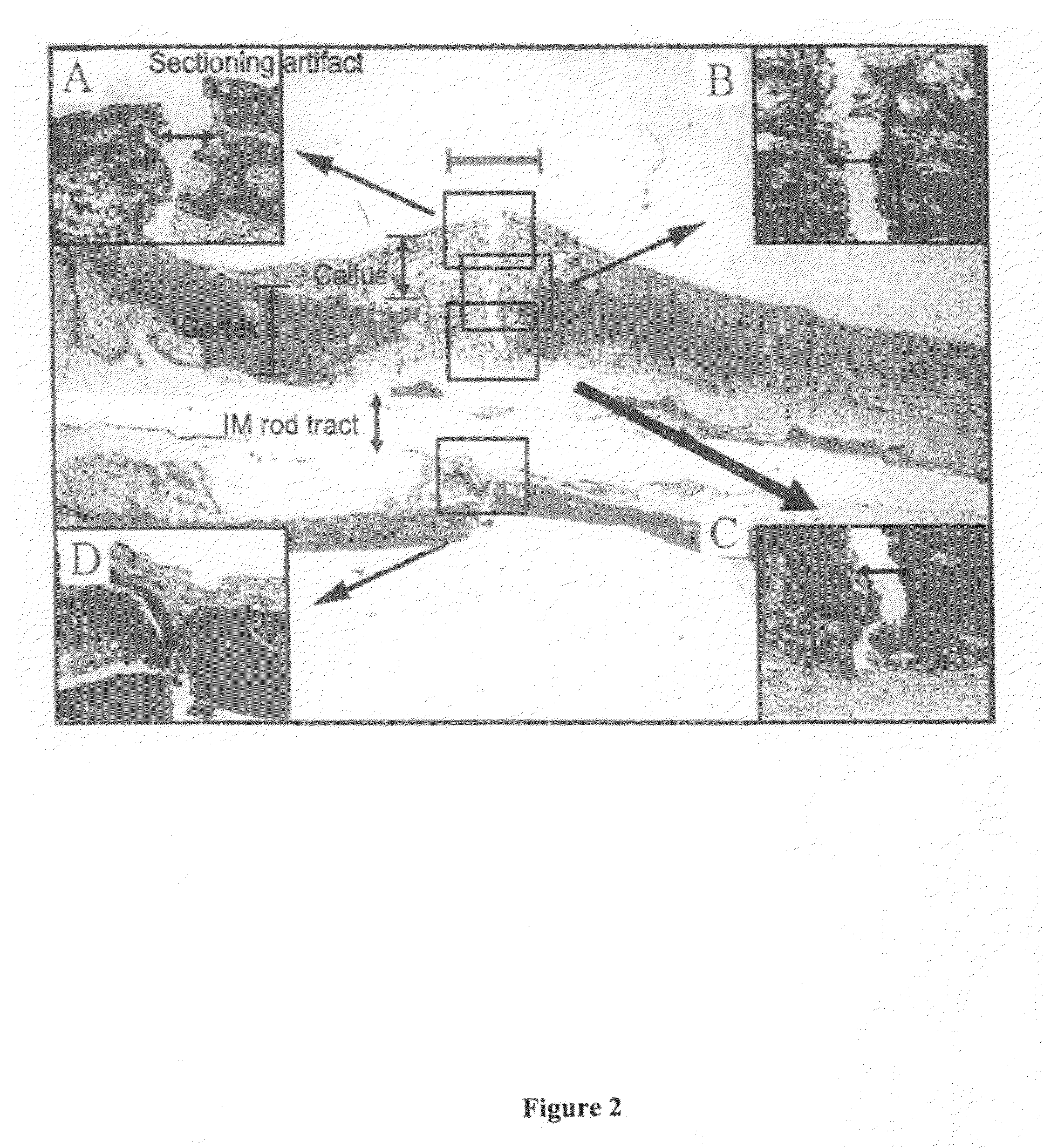 Compositions and methods for treating bone