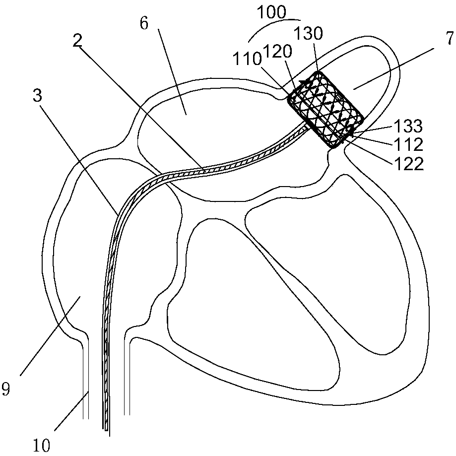 Left atrial appendage occlusion and ablation device