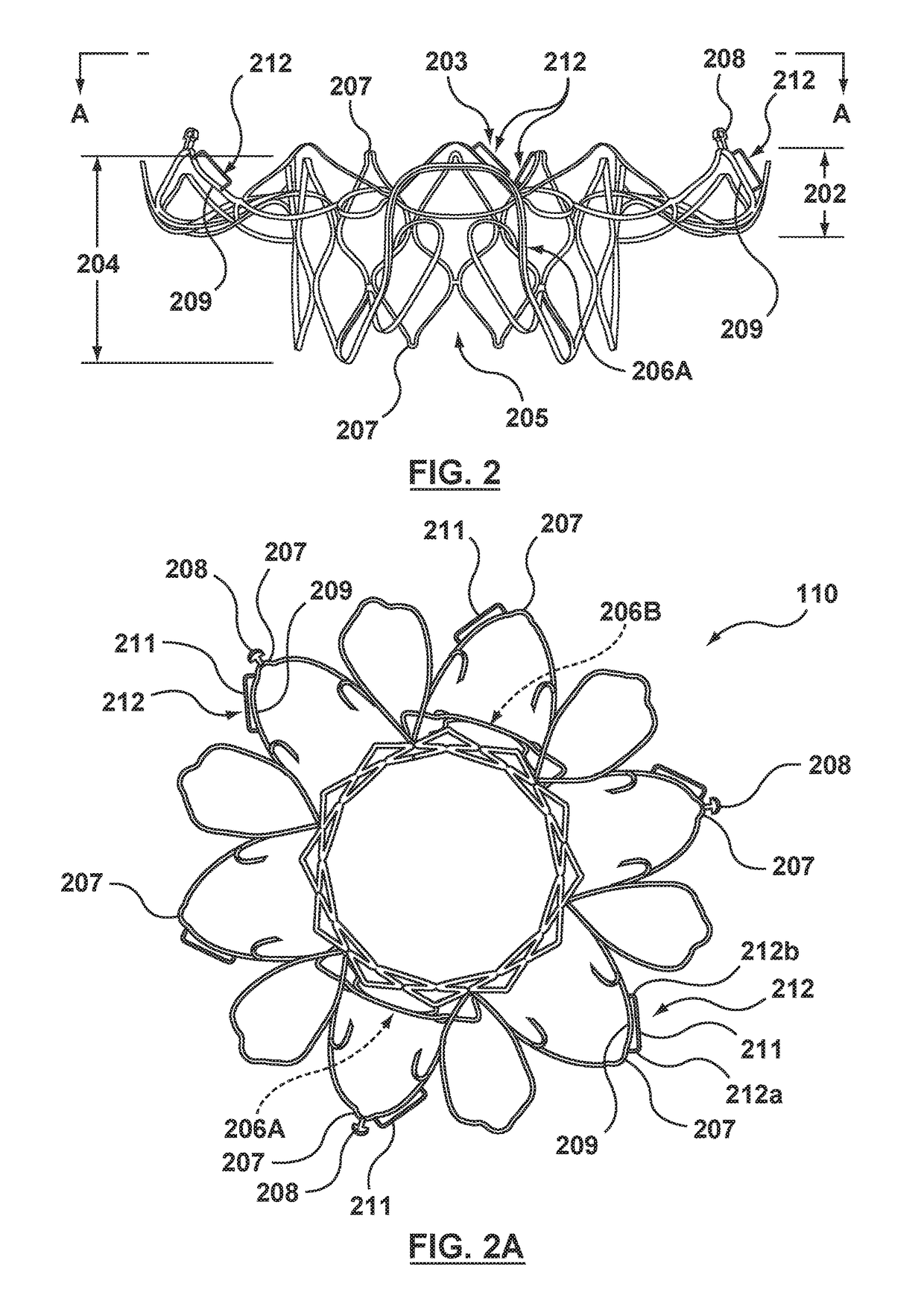 Methods for anchoring a heart valve prosthesis in a transcatheter valve implantation procedure