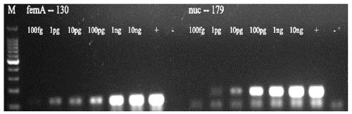 Primer set, kit and detection method for multiplex PCR detection of Staphylococcus aureus and Shigella in food