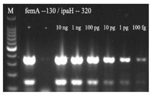 Primer set, kit and detection method for multiplex PCR detection of Staphylococcus aureus and Shigella in food