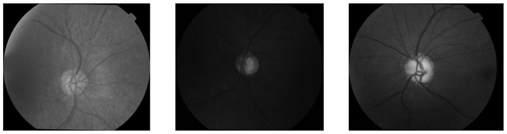 Eye fundus image optic cup and optic disc segmentation method under unified framework
