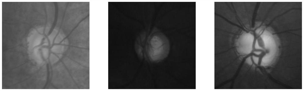 Eye fundus image optic cup and optic disc segmentation method under unified framework