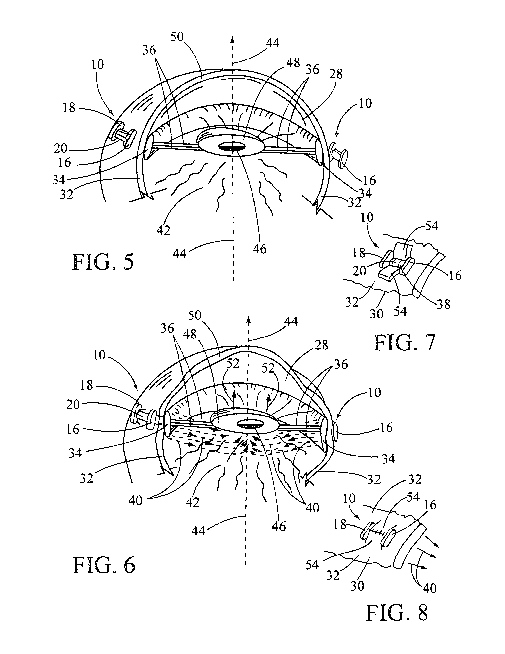Reading enhancement device for preventing and treating presbyopia of the eye