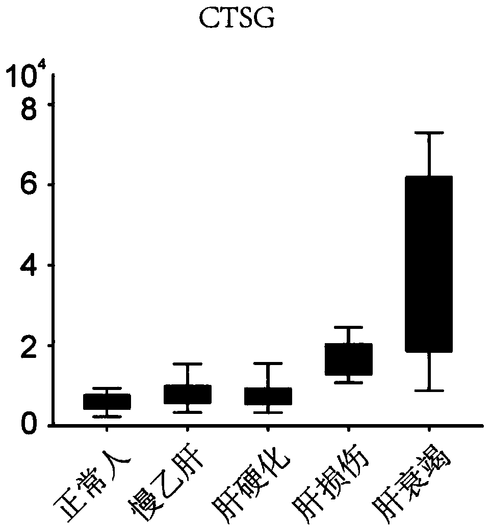 New use of CTSG for diagnosing liver failure, kit and application of kit for diagnosing liver failure