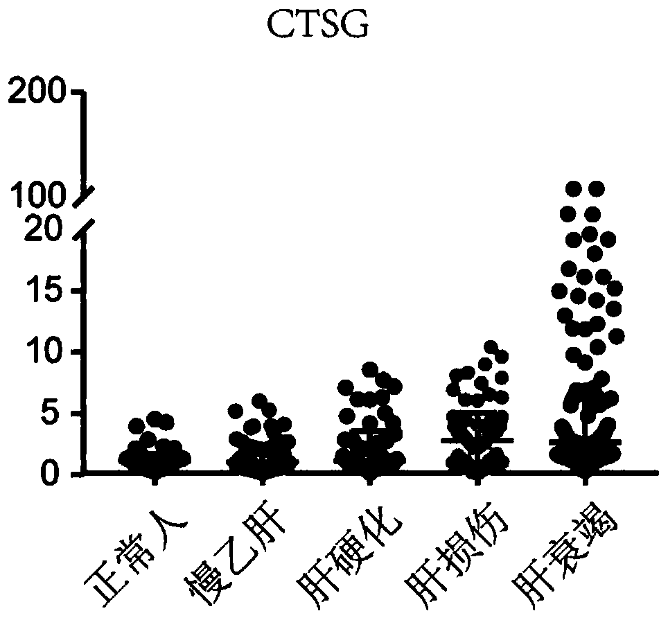 New use of CTSG for diagnosing liver failure, kit and application of kit for diagnosing liver failure