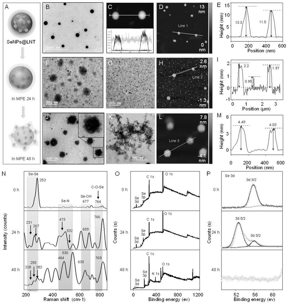 Lentinan nano-selenium, preparation method and application of lentinan nano-selenium in treating malignant pleural effusion