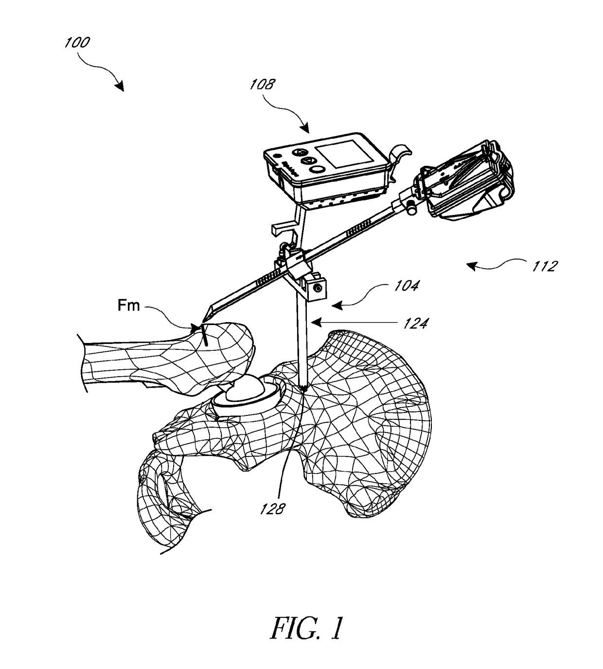 Hip replacement navigation system and method