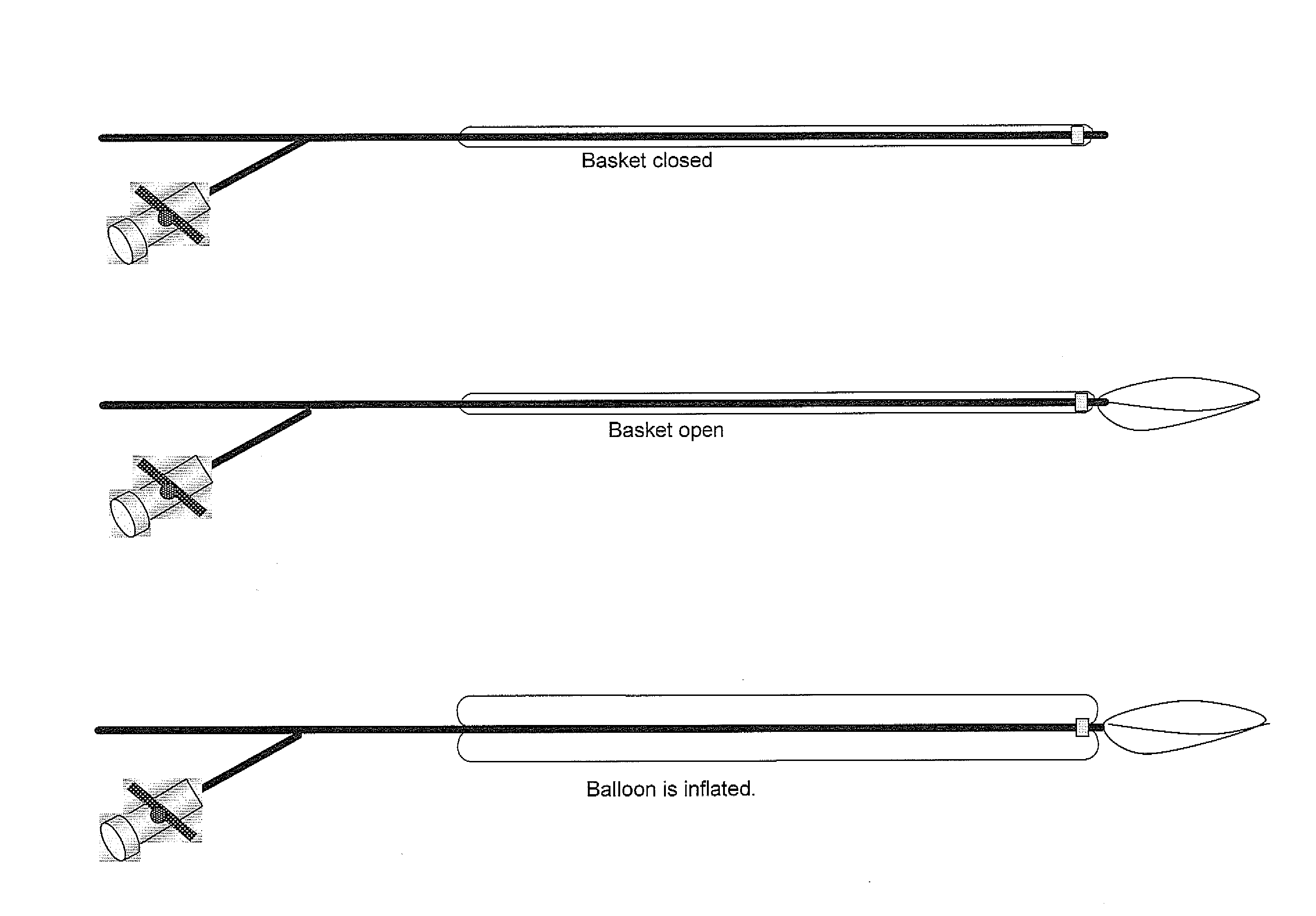 Method and device fo extracting objects from the body