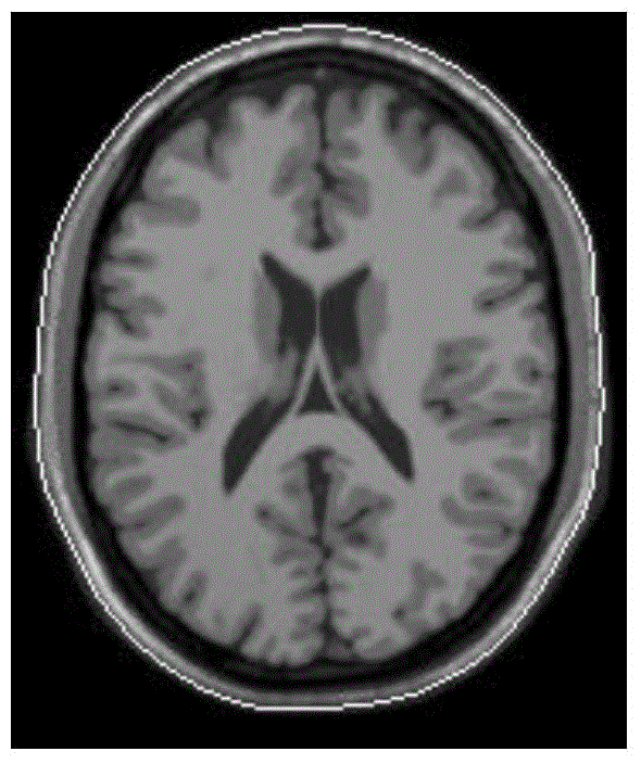 Full-automatic medical image registration method based on combined point matching