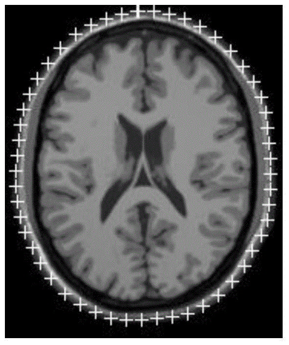 Full-automatic medical image registration method based on combined point matching