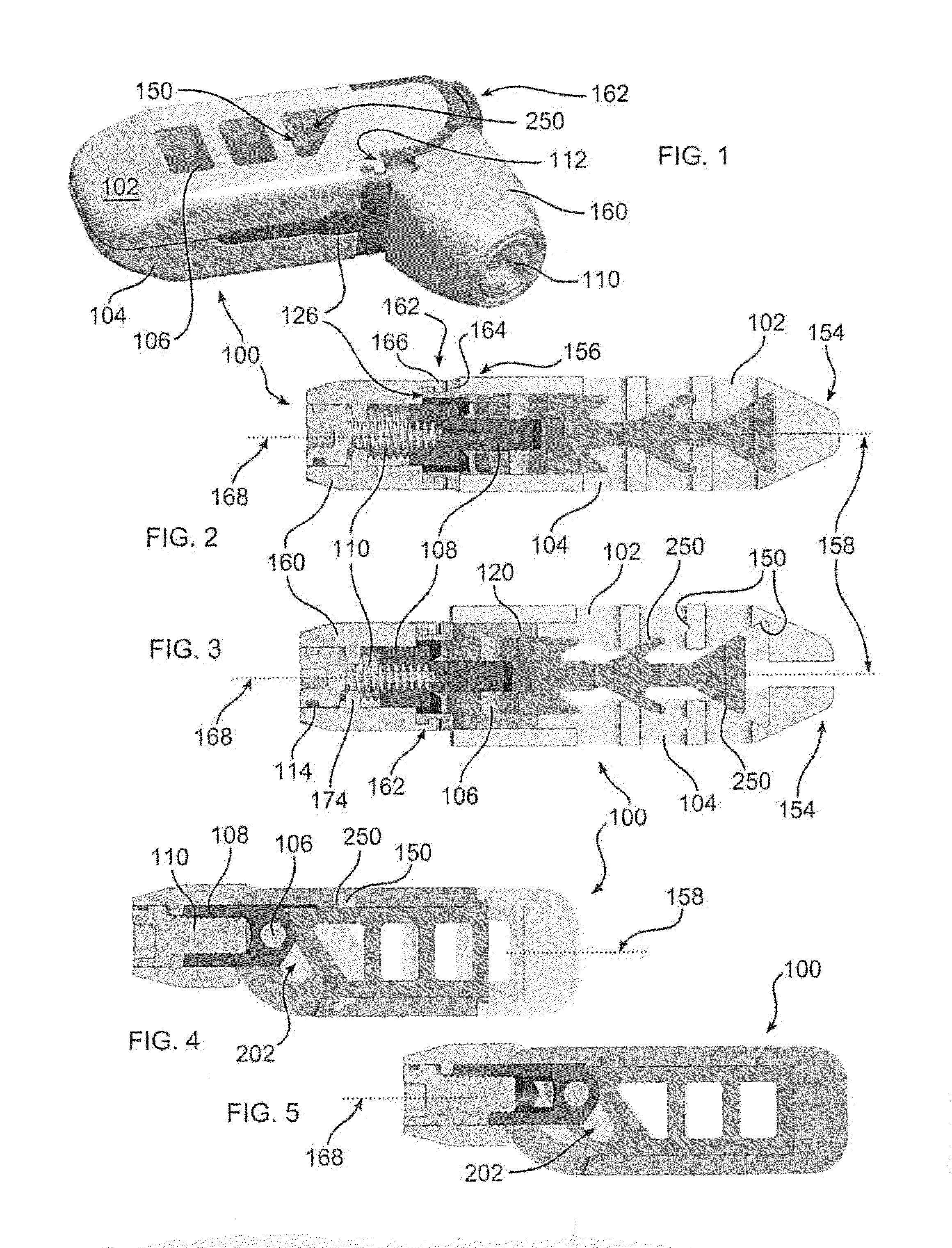 Articulating Expandable Intervertebral Implant