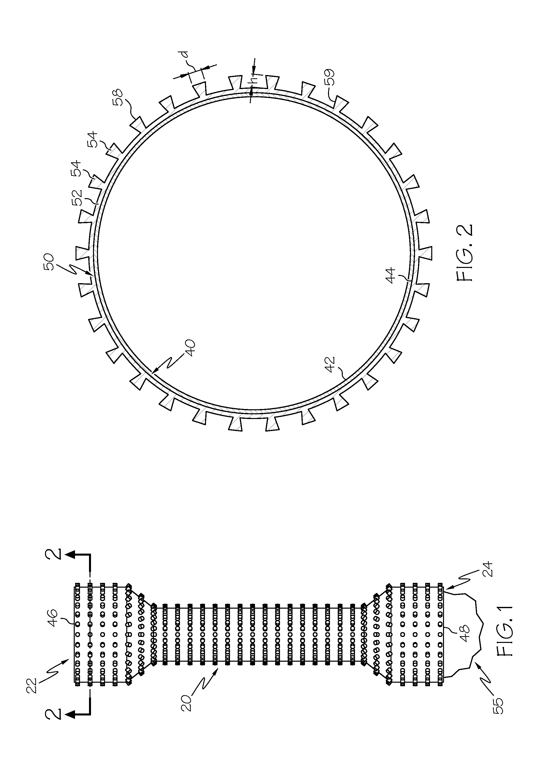 Covered Endoscopic Stents with Adhesion Elements