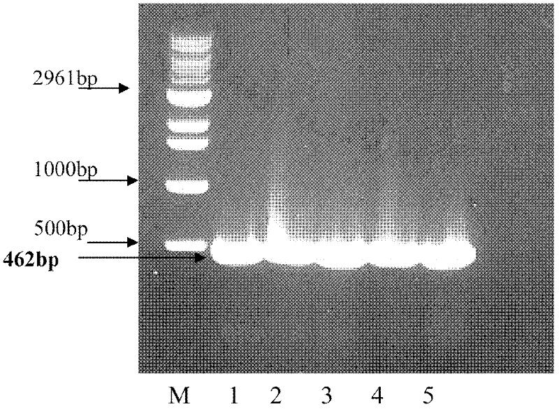 Glutamyl trna synthetase (GTS) fragments