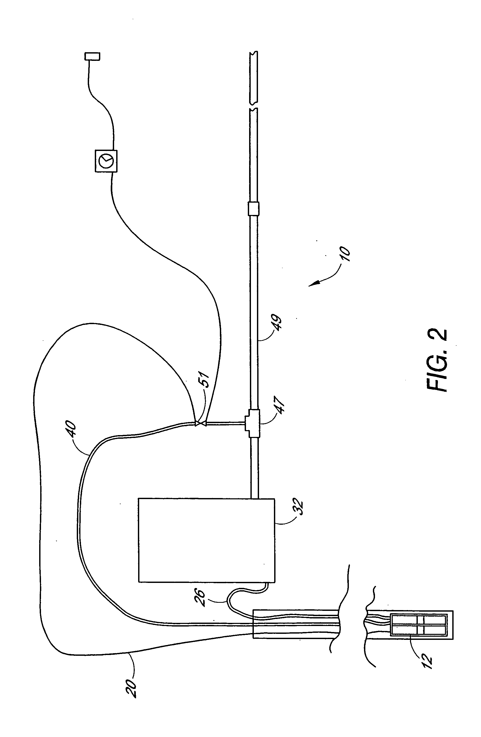 Method and system for filtering sediment-bearing fluids